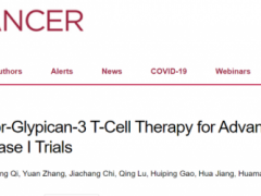 中国研发全球首个靶向GPC3靶点的CAR-T细胞疗法CAR-GPC3 T细胞免疫疗法,CAR-T临床试验招募进行中