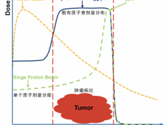 质子治疗肿瘤,靠什么杀死癌细胞,哪些人适合