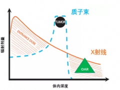 鼻咽癌放疗,鼻咽癌放射治疗,鼻咽癌质子治疗效果,质子治疗鼻咽癌的效果