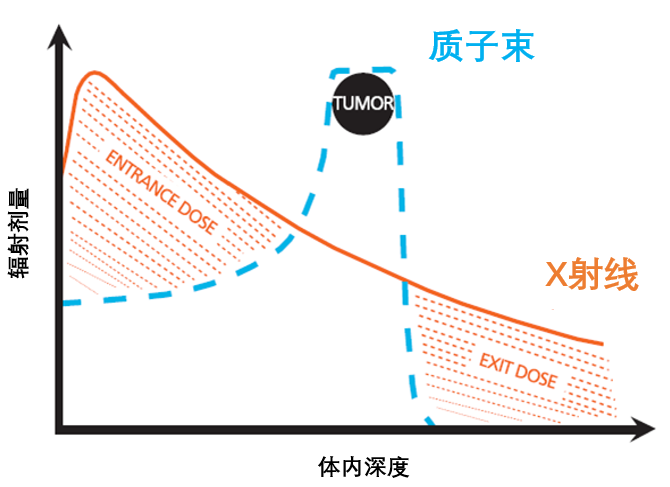 质子治疗和X线治疗剂量分布