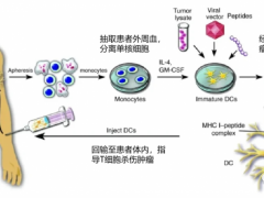 个性化疫苗,肿瘤DC疫苗,DC治疗,DC疗法开启抗癌新模式