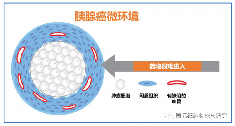 胰腺癌微环境