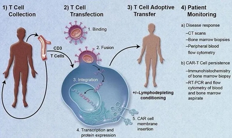 CAR-T细胞治疗机制示意图