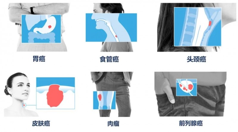 细胞免疫疗法适应症
