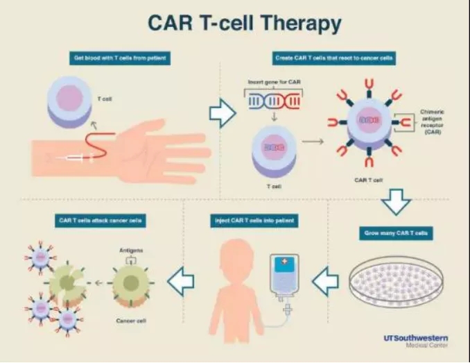 CAR-T细胞免疫疗法治疗流程