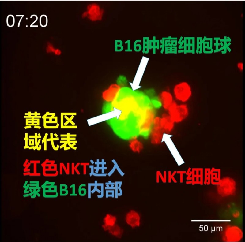 NKT细胞