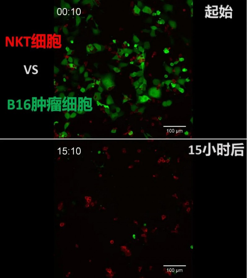 NKT细胞和B16肿瘤细胞