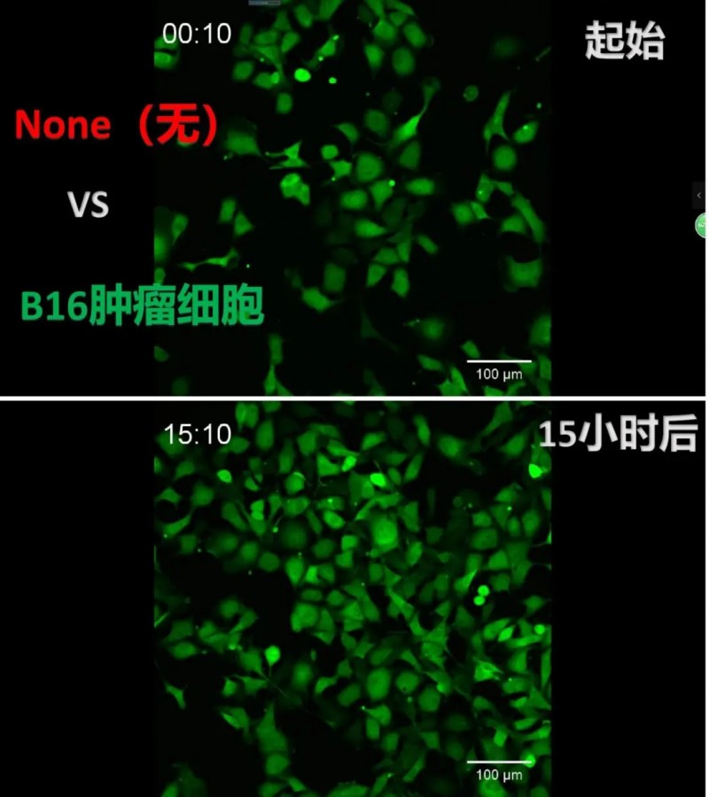 NONE和B16肿瘤细胞