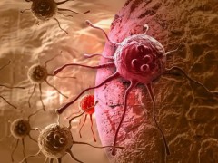 肿瘤细胞疗法怎么样才能获得好疗效