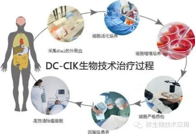 细胞生物治疗肿瘤的过程