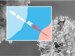 肿瘤细胞免疫治疗,肿瘤细胞免疫疗法让"带瘤生存"成为现实