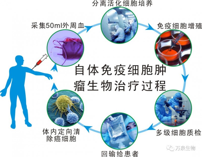癌症肿瘤自体免疫细胞治疗自体细胞免疫疗法