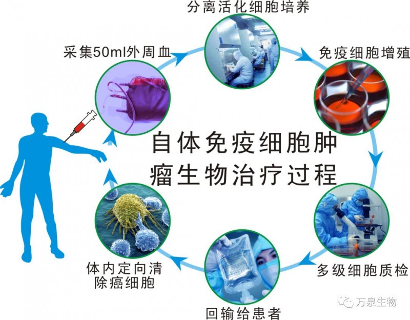 自体免疫细胞肿瘤生物治疗过程