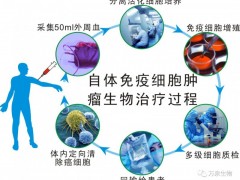 癌症肿瘤自体免疫细胞治疗,自体细胞免疫疗法