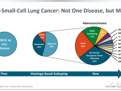 2021年非小细胞肺癌临床试验有哪些及非小细胞肺癌分类类型、靶向治疗