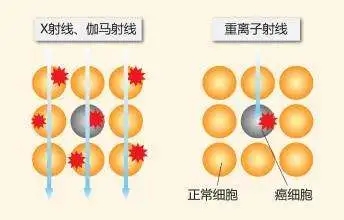 不同放射线对比