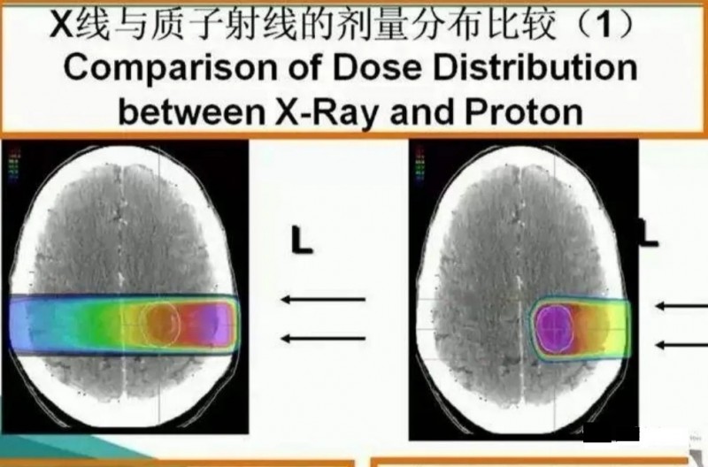 X射线和质子射线的放射剂量对比