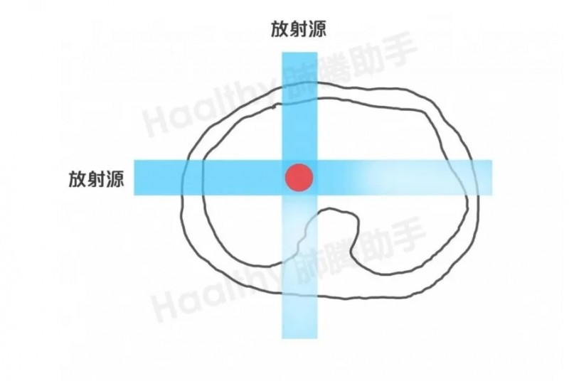 质子治疗放射源