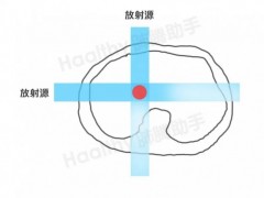 质子重离子治疗是什么意思,质子重离子可以治疗哪些肿瘤,质子重离子治疗适应症