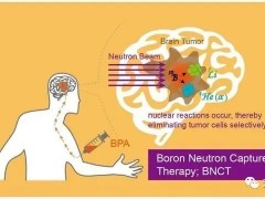 抗癌圈"大热"的BNCT硼中子俘获治疗法被中国专家攻克,同时硼中子临床试验即将招募患者