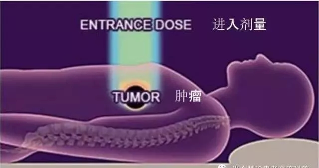 质子放疗放射剂量