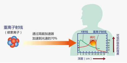 重离子射线和X射线对比