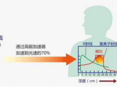 质子治疗是什么疗法