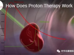 质子放射治疗是什么意思,质子治疗适应症,质子治疗中心,质子治疗费用是多少,质子治疗多少钱