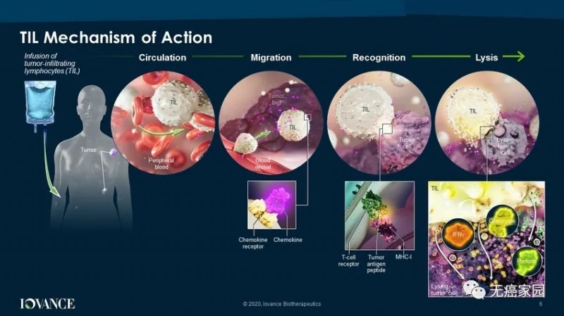 TILs疗法治疗过程
