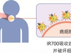 癌症肿瘤光免疫治疗,光免疫疗法已在20家日本医院中开始实施