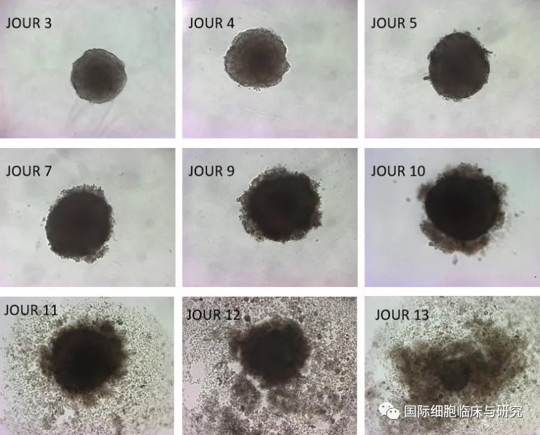 最新研究:欧米伽3可杀死癌细胞,减缓肿瘤的生长,12种富含欧米伽3的食物不容错过