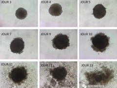 欧米伽3抗癌,欧米伽3是什么,欧米伽3的作用与功效,什么食物含有欧米伽3(ω-3)