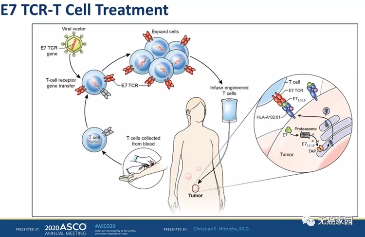 E7 TCR-T细胞治疗过程
