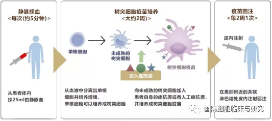 树突细胞疫苗疗法的流程