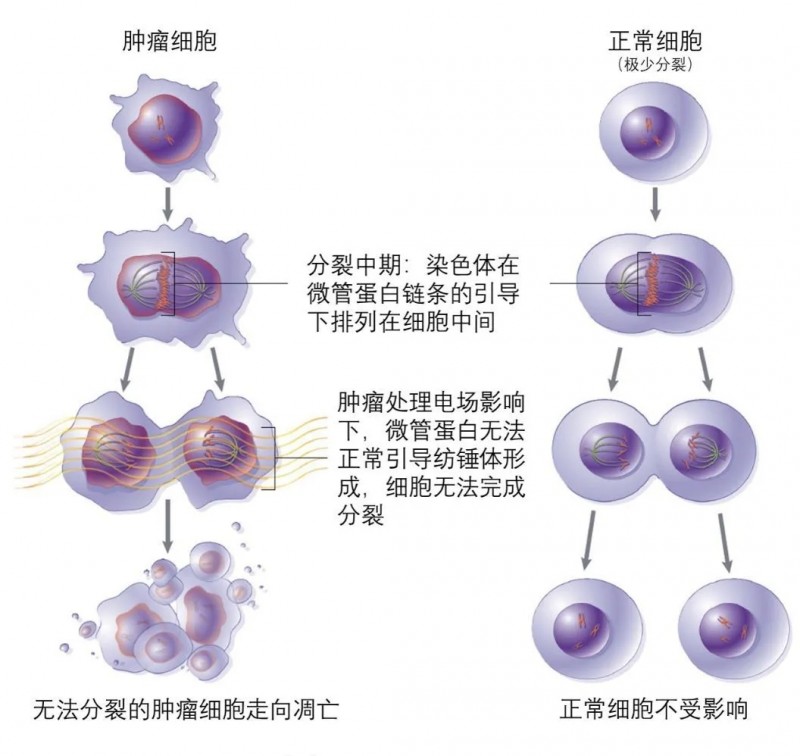 电场是怎么杀死癌细胞的