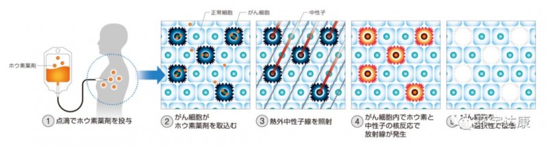 硼中子俘获疗法的原理