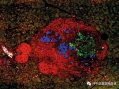 干细胞治疗糖尿病,Nature重磅​:太神奇!​干细胞竟能成功修复难治性Ⅰ型糖尿病