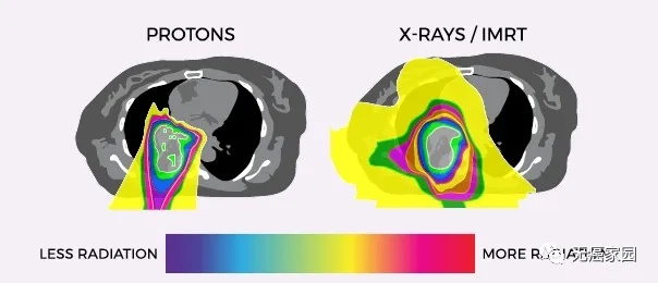 肺癌质子治疗和X射线治疗辐射面积对比