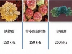 电场治疗肿瘤癌症,​成功阻止癌细胞分裂​!电场疗法强效对抗七大实体瘤"魔头"