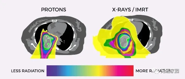 肺癌质子治疗和传统放疗辐射面积对比