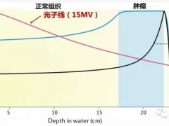 湖南省肿瘤医院放射治疗科刘怀医生:探秘肿瘤质子治疗