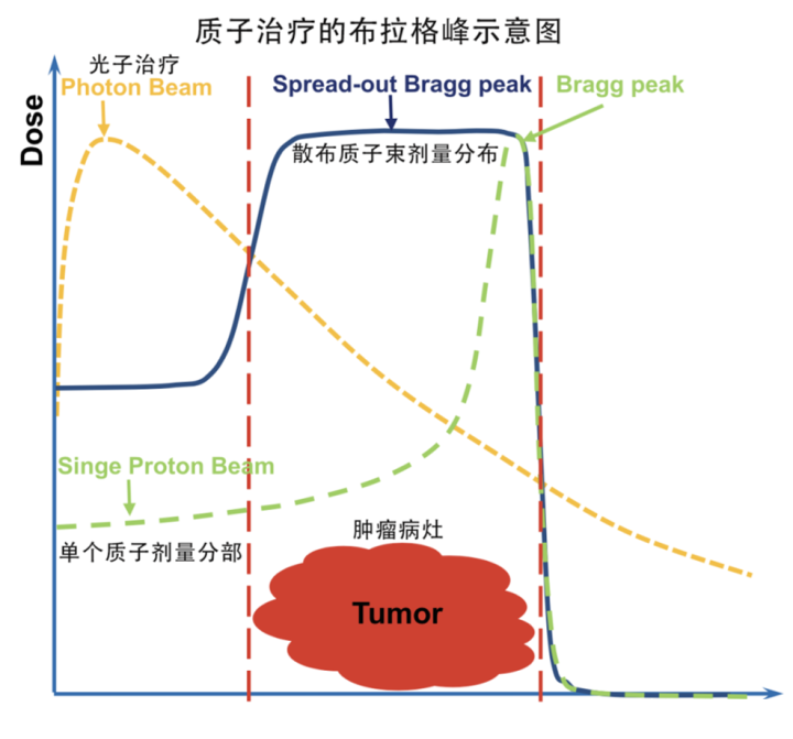 质子治疗布拉格峰示意图