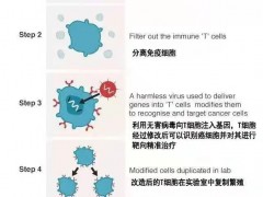 新型多靶点CAR-T细胞疗法治疗多种癌症肿瘤蓄势待发,更多CAR-T临床试验招募正在进行中