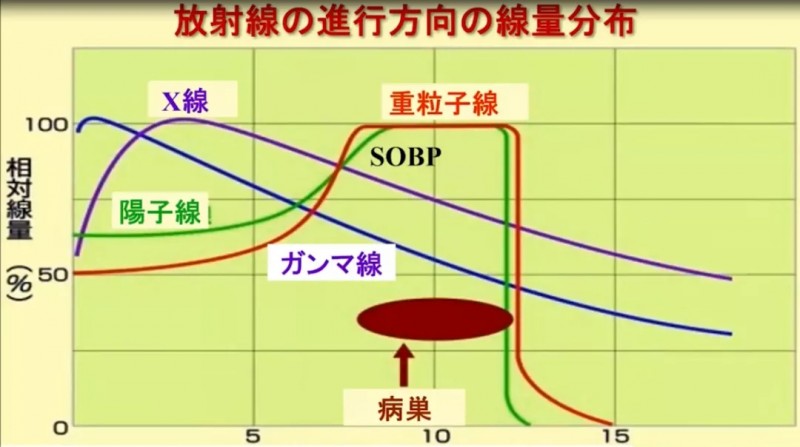 不同射线对比