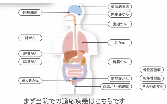 重离子治疗适应症