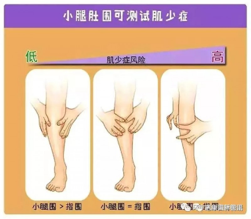小腿肚围测量测试肌少症的方法