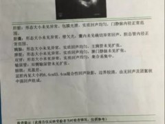 癌症肿瘤第二诊疗意见很关键,警惕这些"第一次"