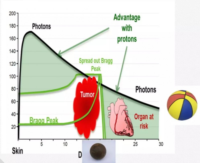 质子重离子放疗跟普通放疗的区别