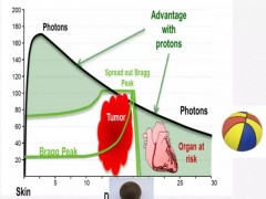 质子和放疗的区别,质子重离子放疗跟普通放疗的区别,质子重离子和放疗效果是不是一样的