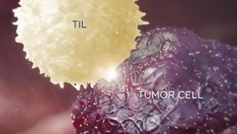 TIL细胞